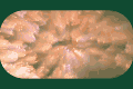 six